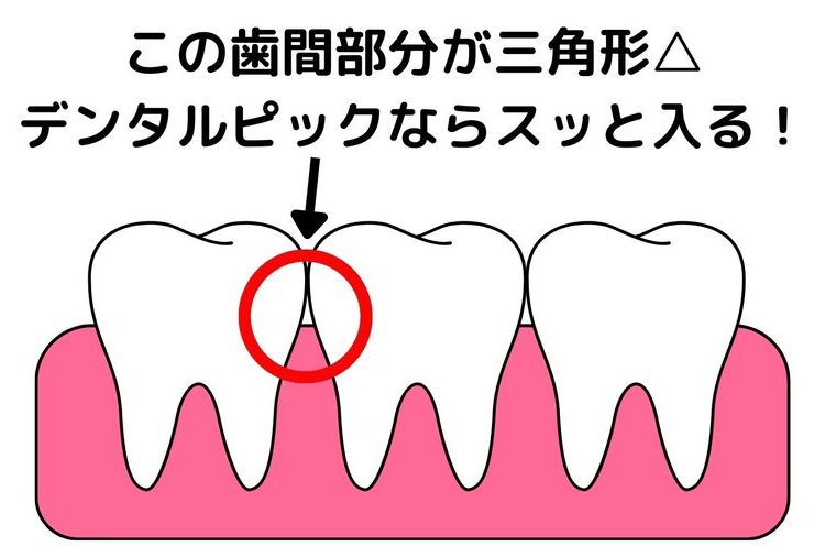 デンタルピック